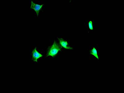 Immunofluorescence staining of SY5Y Cells with RAC07812 at 1:50, counter-stained with DAPI. The cells were fixed in 4% formaldehyde, permeated by 0.2% TritonX-100, and blocked in 10% normal Goat Serum. The cells were then incubated with the antibody overnight at 4?. Nuclear DNA was labeled in blue with DAPI. The secondary antibody was FITC-conjugated AffiniPure Goat Anti-Rabbit IgG (H+L).