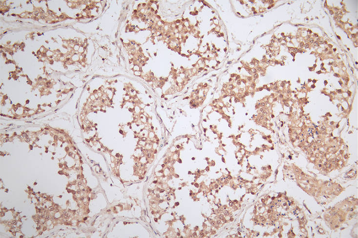 IHC image of RAC07814 diluted at 1:50 and staining in paraffin-embedded human testis tissue performed on a Leica BondTM system. After dewaxing and hydration, antigen retrieval was mediated by high pressure in a citrate buffer (pH 6.0). Section was blocked with 10% normal goat serum 30min at RT. Then primary antibody (1% BSA) was incubated at 4Â°C overnight. The primary is detected by a Goat anti-rabbit polymer IgG labeled by HRP and visualized using 0.79% DAB.