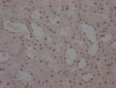 IHC image of RAC07816 diluted at 1:100 and staining in paraffin-embedded human kidney tissue performed on a Leica BondTM system. After dewaxing and hydration, antigen retrieval was mediated by high pressure in a citrate buffer (pH 6.0). Section was blocked with 10% normal goat serum 30min at RT. Then primary antibody (1% BSA) was incubated at 4? overnight. The primary is detected by a Goat anti-rabbit IgG polymer labeled by HRP and visualized using 0.05% DAB.