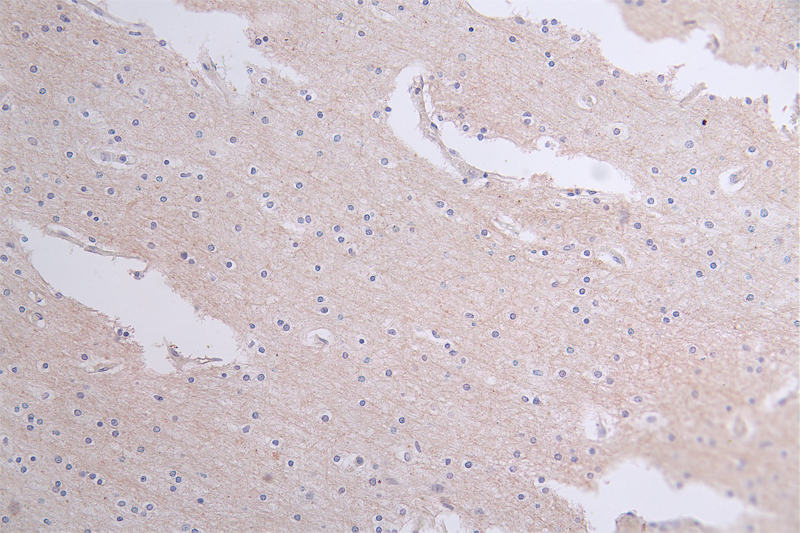 IHC image diluted at 1:50 and staining in paraffin-embedded human brain tissue performed on a Leica BondTM system. After dewaxing and hydration, antigen retrieval was mediated by high pressure in a citrate buffer (pH 6.0). Section was blocked with 10% normal goat serum 30min at RT. Then primary antibody (1% BSA) was incubated at 4Â°C overnight. The primary is detected by a Goat anti-rabbit polymer IgG labeled by HRP and visualized using 0.60% DAB.