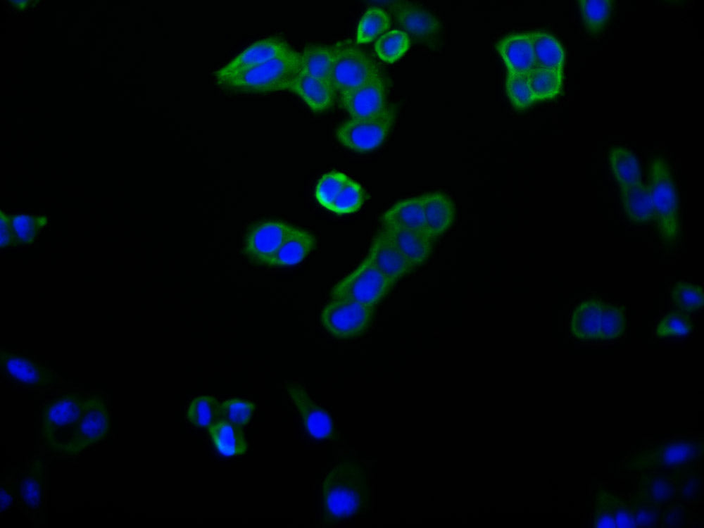 Immunofluorescence staining of PC-3 cell with RAC07818 at 1:50, counter-stained with DAPI. The cells were fixed in 4% formaldehyde and blocked in 10% normal Goat Serum. The cells were then incubated with the antibody overnight at 4Â°C. The secondary antibody was Alexa Fluor 494-congugated AffiniPure Goat Anti-Rabbit IgG(H+L).