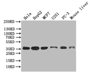 Western Blot; Positive WB detected in: Hela whole cell lysate, HepG2 whole cell lysate, MCF7 whole cell lysate, U251 whole cell lysate, PC-3 whole cell lysate, Mouse Liver tissue lysate; All lanes: ANXA4 antibody at 1:500; Secondary; Goat polyclonal to mouse IgG at 1/50000 dilution; Predicted band size: 36 kDa; Observed band size: 36 kDa