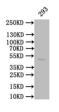 Western Blot; Positive WB detected in: 293 whole cell lysate; All lanes: CALR antibody at 1:1000; Secondary; Goat polyclonal to mouse IgG at 1/50000 dilution; Predicted band size: 49 kDa; Observed band size: 49 kDa