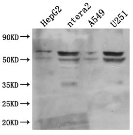 Western Blot; Positive WB detected in: HepG2 whole cell lysate, ntera2 whole cell lysate, A549 whole cell lysate, U251 whole cell lysate ; All lanes: CD147 antibody at 1:1000; Secondary; Goat polyclonal to mouse IgG at 1/50000 dilution; Predicted band size: 42, 29, 23, 19 KDa; Observed band size: 35, 50-60 KDa