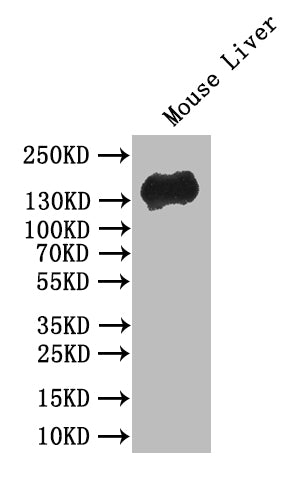 Western Blot; Positive WB detected in: Mouse Liver tissue lysate; All lanes: CDH1 antibody at 1:500; Secondary; Goat polyclonal to mouse IgG at 1/50000 dilution; Predicted band size: 80-135 kDa; Observed band size: 135 kDa