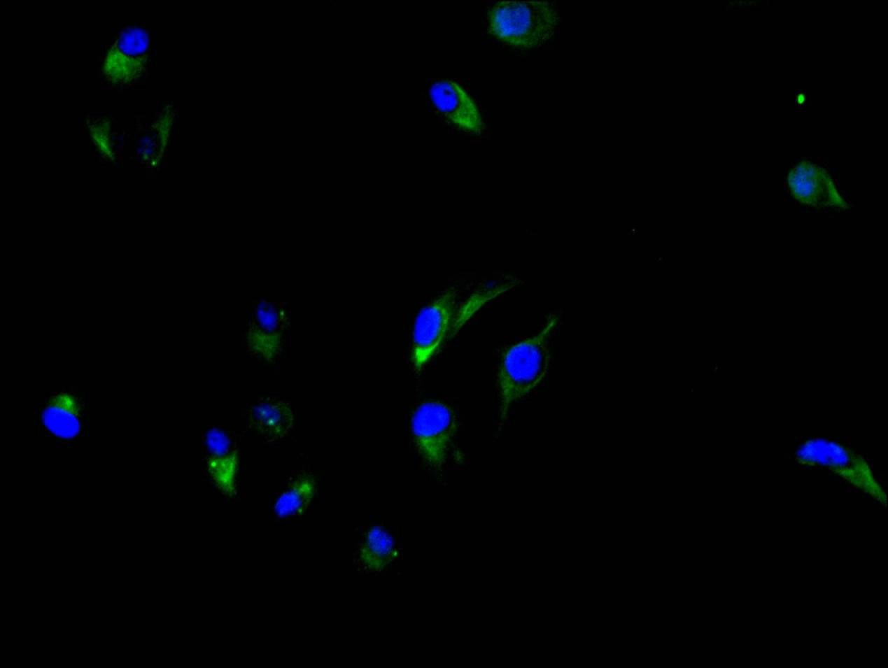 Immunofluorescence staining of Hela cell with RAC07848 at 1:150, counter-stained with DAPI. The cells were fixed in 4% formaldehyde and blocked in 10% normal Goat Serum. The cells were then incubated with the antibody overnight at 4C. The secondary antibody was FITC-conjugated AffiniPure Goat Anti-human IgG(H+L).