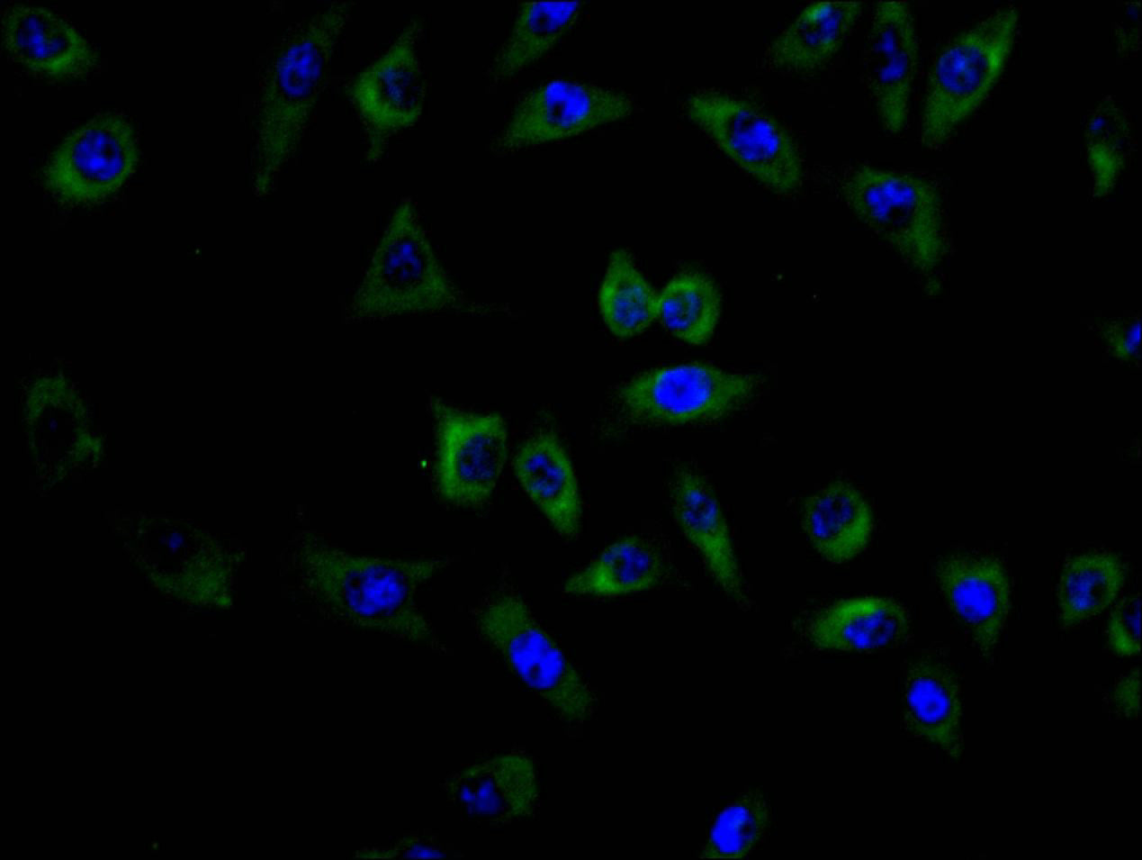 Immunofluorescence staining of MCF7 cell with RAC07848 at 1:150, counter-stained with DAPI. The cells were fixed in 4% formaldehyde and blocked in 10% normal Goat Serum. The cells were then incubated with the antibody overnight at 4C. The secondary antibody was FITC-conjugated AffiniPure Goat Anti-human IgG(H+L).
