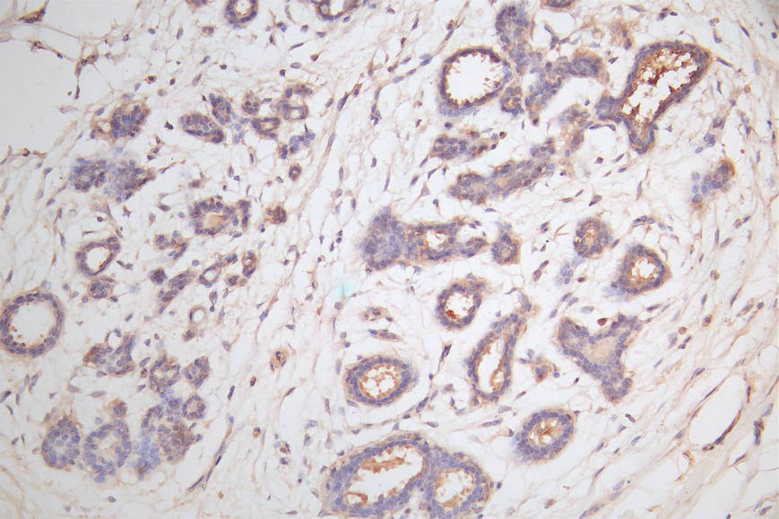 IHC image of RAC07857 diluted at 1:100 and staining in paraffin-embedded human breast tissue performed on a Leica BondTM system. After dewaxing and hydration, antigen retrieval was mediated by high pressure in a citrate buffer (pH 6.0). Section was blocked with 10% normal goat serum 30min at RT. Then primary antibody (1% BSA) was incubated at 4Â°C overnight. The primary is detected by a Goat anti-rabbit polymer IgG labeled by HRP and visualized using 0.05% DAB.