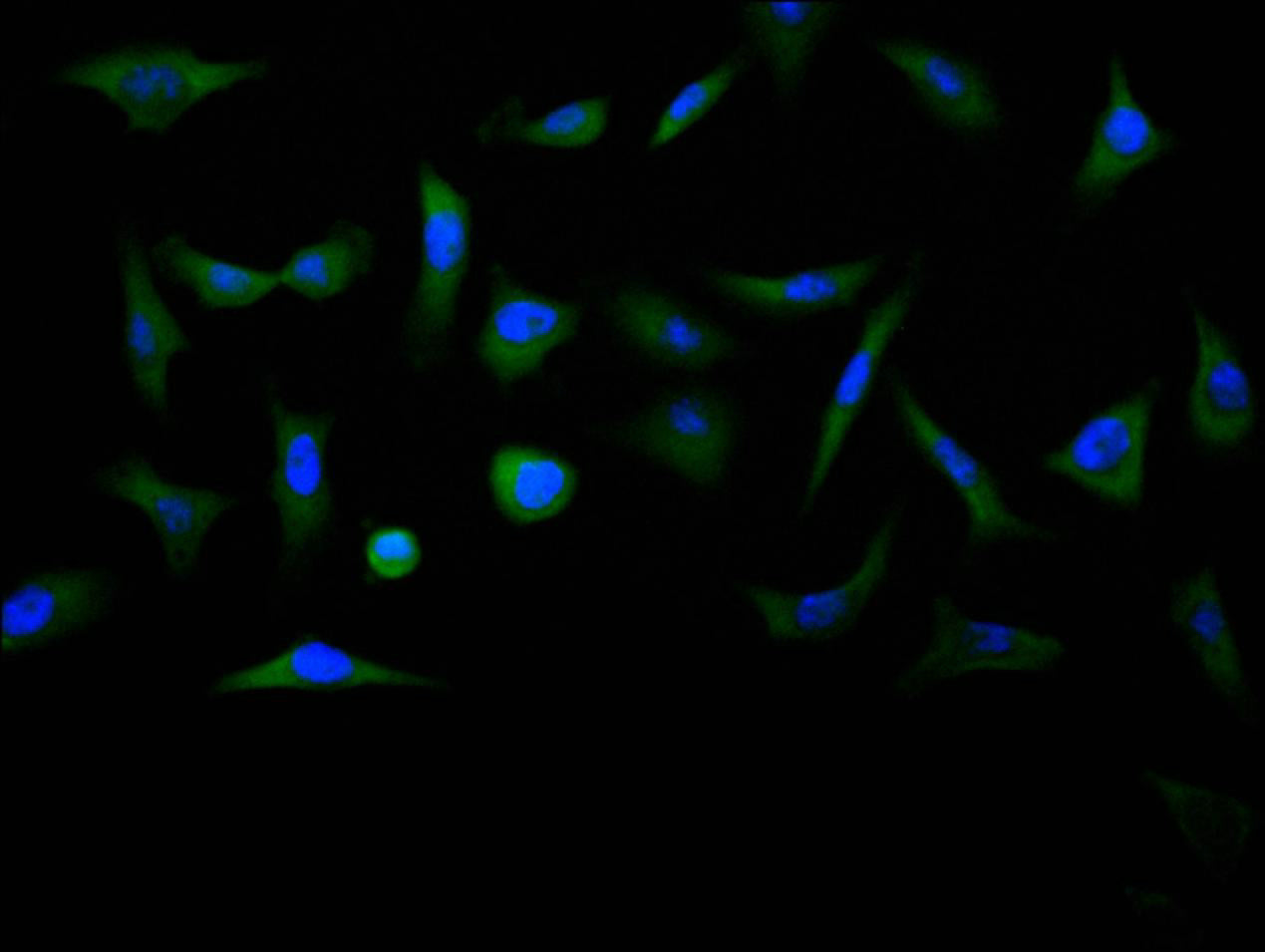 Immunofluorescence staining of MCF7 cell with RAC07857 at 1:200, counter-stained with DAPI. The cells were fixed in 4% formaldehyde and blocked in 10% normal Goat Serum. The cells were then incubated with the antibody overnight at 4C. The secondary antibody was Alexa Fluor 488-congugated AffiniPure Goat Anti-rabbit IgG(H+L).