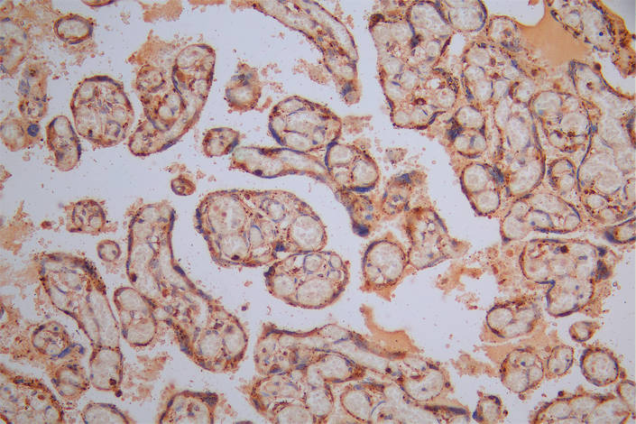 IHC image of RAC07858 diluted at 1:30 and staining in paraffin-embedded human placenta tissue performed on a Leica BondTM system. After dewaxing and hydration, antigen retrieval was mediated by high pressure in a citrate buffer (pH 6.0). Section was blocked with 10% normal goat serum 30min at RT. Then primary antibody (1% BSA) was incubated at 4Â°C overnight. The primary is detected by a Goat anti-Mouse IgG labeled by HRP and visualized using 0.05% DAB.