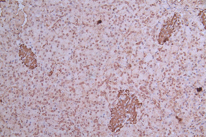 IHC image of RAC07864 diluted at 1:50 and staining in paraffin-embedded human pancreatic tissue performed on a Leica BondTM system. After dewaxing and hydration, antigen retrieval was mediated by high pressure in a citrate buffer (pH 6.0). Section was blocked with 10% normal goat serum 30min at RT. Then primary antibody (1% BSA) was incubated at 4Â°C overnight. The primary is detected by a Goat anti-rabbit polymer IgG labeled by HRP and visualized using 0.05% DAB.