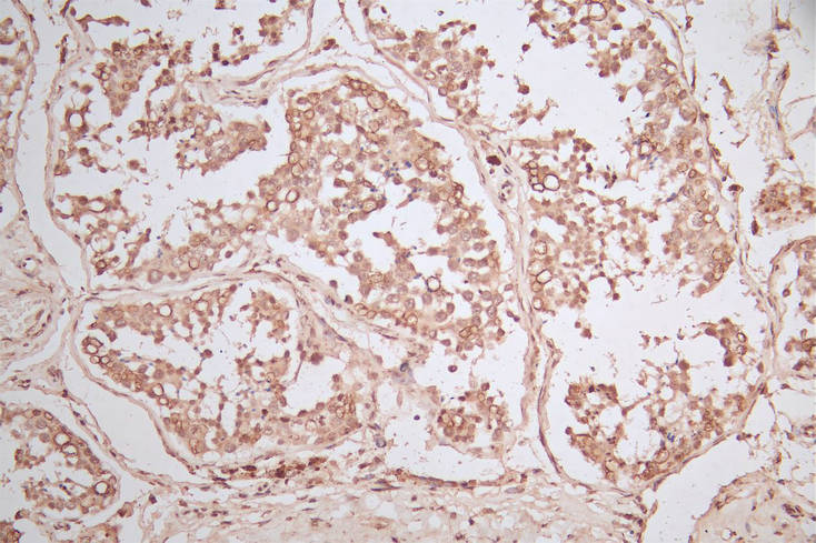 IHC image of RAC07867 diluted at 1:600 and staining in paraffin-embedded human testis tissue performed on a Leica BondTM system. After dewaxing and hydration, antigen retrieval was mediated by high pressure in a citrate buffer (pH 6.0). Section was blocked with 10% normal goat serum 30min at RT. Then primary antibody (1% BSA) was incubated at 4Â°C overnight. The primary is detected by a Goat Goat anti-Mouse IgG labeled by HRP and visualized using 0.05% DAB.