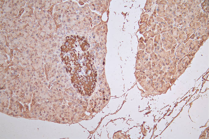 IHC image of RAC07869 diluted at 1:100 and staining in paraffin-embedded human pancreatic tissue performed on a Leica BondTM system. After dewaxing and hydration, antigen retrieval was mediated by high pressure in a citrate buffer (pH 6.0). Section was blocked with 10% normal goat serum 30min at RT. Then primary antibody (1% BSA) was incubated at 4Â°C overnight. The primary is detected by a Goat anti-Rabbit IgG labeled by HRP and visualized using 0.05% DAB.
