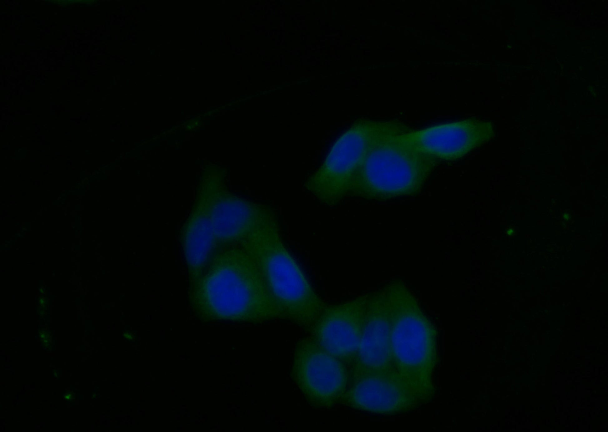 Immunofluorescence staining of Hela cell with RAC07869 at 1:20, counter-stained with DAPI. The cells were fixed in 4% formaldehyde and blocked in 10% normal Goat Serum. The cells were then incubated with the antibody overnight at 4C. The secondary antibody was FITC-conjugated AffiniPure Goat Anti-Rabbit IgG(H+L).