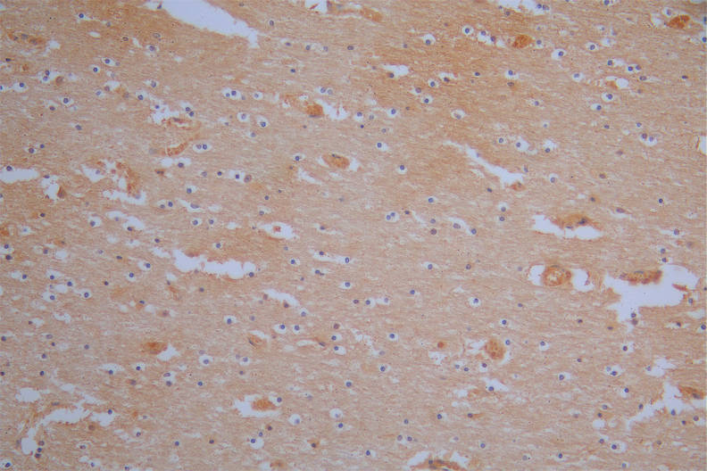 IHC image of RAC07871 diluted at 1:200 and staining in paraffin-embedded human brain tissue performed on a Leica BondTM system. After dewaxing and hydration, antigen retrieval was mediated by high pressure in a citrate buffer (pH 6.0). Section was blocked with 10% normal goat serum 30min at RT. Then primary antibody (1% BSA) was incubated at 4Â°C overnight. The primary is detected by a Goat anti-Mouse IgG labeled by HRP and visualized using 0.05% DAB.