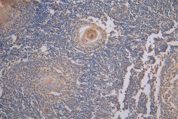 IHC image of RAC07871 diluted at 1:200 and staining in paraffin-embedded human tonsil tissue performed on a Leica BondTM system. After dewaxing and hydration, antigen retrieval was mediated by high pressure in a citrate buffer (pH 6.0). Section was blocked with 10% normal goat serum 30min at RT. Then primary antibody (1% BSA) was incubated at 4Â°C overnight. The primary is detected by a Goat anti-Mouse IgG labeled by HRP and visualized using 0.05% DAB.