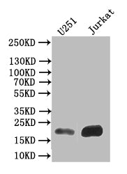 Western Blot; Positive WB detected in: U251 whole cell lysate, JK whole cell lysate; All lanes: FTH1 antibody at 1:500; Secondary; Goat polyclonal to mouse IgG at 1/50000 dilution; Predicted band size: 22 kDa; Observed band size: 22 kDa