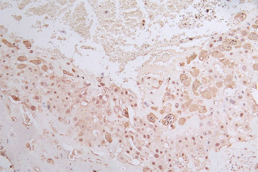 IHC image of RAC07873 diluted at 1:50 and staining in paraffin-embedded human placenta tissue performed on a Leica BondTM system. After dewaxing and hydration, antigen retrieval was mediated by high pressure in a citrate buffer (pH 6.0). Section was blocked with 10% normal goat serum 30min at RT. Then primary antibody (1% BSA) was incubated at 4Â°C overnight. The primary is detected by a Goat anti-rabbit polymer IgG labeled by HRP and visualized using 0.05% DAB.