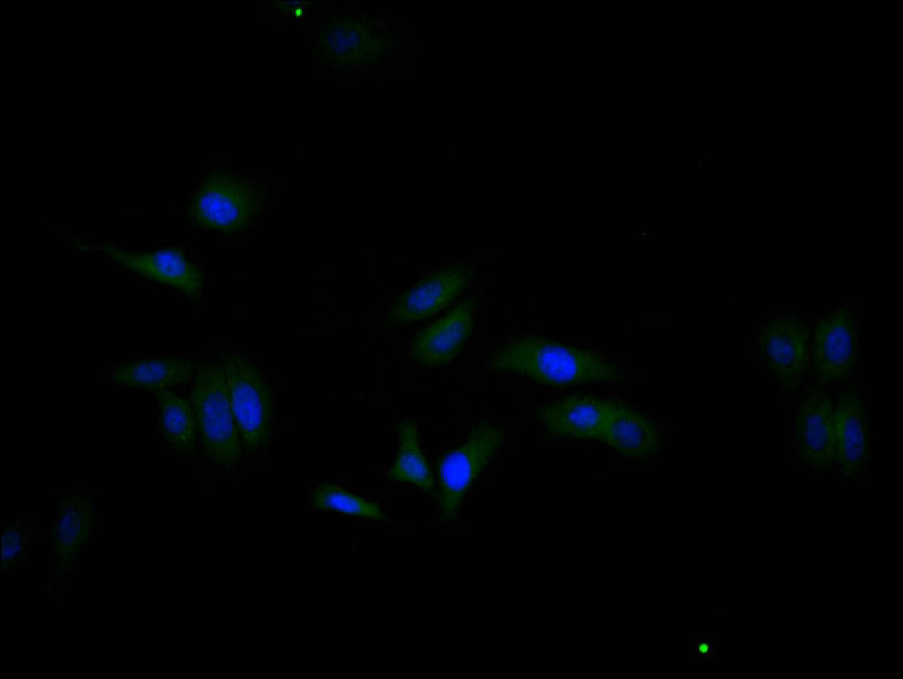 Immunofluorescence staining of HepG2 cell with RAC07873 at 1:20, counter-stained with DAPI. The cells were fixed in 4% formaldehyde and blocked in 10% normal Goat Serum. The cells were then incubated with the antibody overnight at 4C. The secondary antibody was Alexa Fluor 488-congugated AffiniPure Goat Anti-Rabbit IgG(H+L).