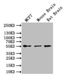 Western Blot; Positive WB detected in: MCF7 whole cell lysate, Mouse Brain tissue lysate, Rat Brain tissue lysate; All lanes: GFAP antibody at 1:1000; Secondary; Goat polyclonal to mouse IgG at 1/50000 dilution; Predicted band size: 50 kDa; Observed band size: 55 kDa