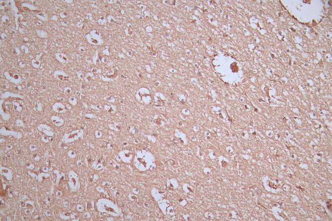 IHC image of RAC07875 diluted at 1:300 and staining in paraffin-embedded human brain tissue performed on a Leica BondTM system. After dewaxing and hydration, antigen retrieval was mediated by high pressure in a citrate buffer (pH 6.0). Section was blocked with 10% normal goat serum 30min at RT. Then primary antibody (1% BSA) was incubated at 4Â°C overnight. The primary is detected by a Goat anti-Mouse IgG labeled by HRP and visualized using 0.05% DAB.