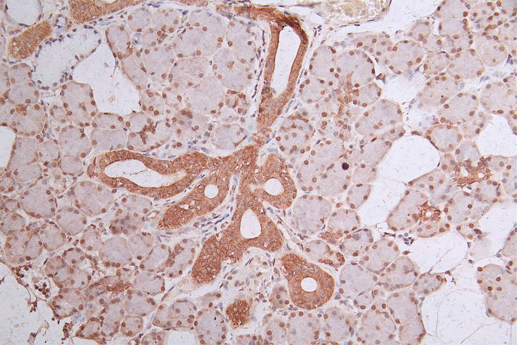 IHC image of RAC07886 diluted at 1:300 and staining in paraffin-embedded human salivary gland tissue performed on a Leica BondTM system. After dewaxing and hydration, antigen retrieval was mediated by high pressure in a citrate buffer (pH 6.0). Section was blocked with 10% normal goat serum 30min at RT. Then primary antibody (1% BSA) was incubated at 4Â°C overnight. The primary is detected by a Goat anti-Mouse IgG labeled by HRP and visualized using 0.05% DAB.