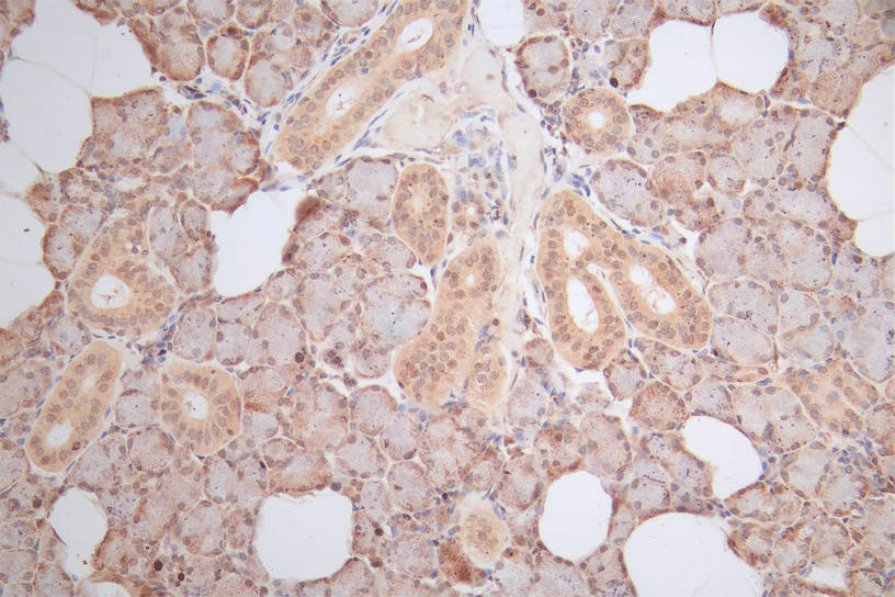 IHC image of RAC07888 diluted at 1:100 and staining in paraffin-embedded human salivary gland tissue performed on a Leica BondTM system. After dewaxing and hydration, antigen retrieval was mediated by high pressure in a citrate buffer (pH 6.0). Section was blocked with 10% normal goat serum 30min at RT. Then primary antibody (1% BSA) was incubated at 4Â°C overnight. The primary is detected by a Goat anti-Mouse IgG labeled by HRP and visualized using 0.05% DAB.