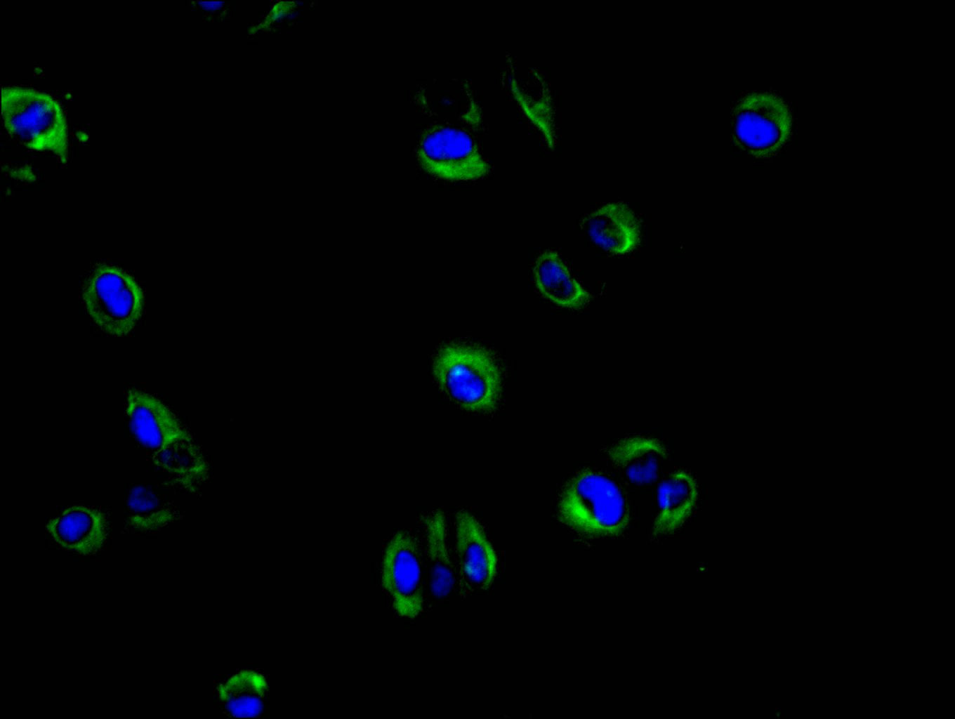 Immunofluorescence staining of Hela cell with RAC07894 at 1:30, counter-stained with DAPI. The cells were fixed in 4% formaldehyde and blocked in 10% normal Goat Serum. The cells were then incubated with the antibody overnight at 4C. The secondary antibody was FITC-conjugated AffiniPure Goat Anti-human IgG(H+L).