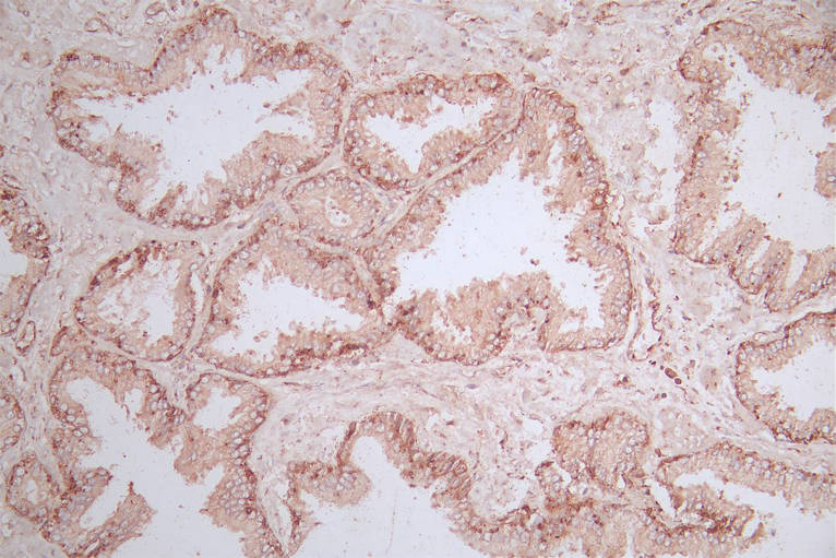 IHC image of RAC07904 diluted at 1:600 and staining in paraffin-embedded human prostate tissue performed on a Leica BondTM system. After dewaxing and hydration, antigen retrieval was mediated by high pressure in a citrate buffer (pH 6.0). Section was blocked with 10% normal goat serum 30min at RT. Then primary antibody (1% BSA) was incubated at 4Â°C overnight. The primary is detected by a Goat anti-Mouse IgG labeled by HRP and visualized using 0.05% DAB.