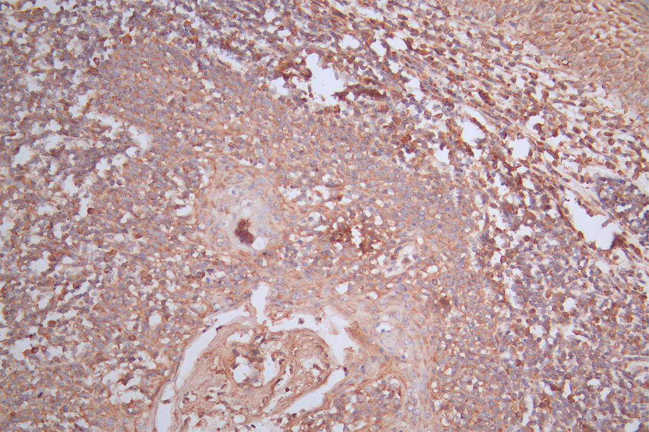 IHC image of RAC07907 diluted at 1:200 and staining in paraffin-embedded human tonsil tissue performed on a Leica BondTM system. After dewaxing and hydration, antigen retrieval was mediated by high pressure in a citrate buffer (pH 6.0). Section was blocked with 10% normal goat serum 30min at RT. Then primary antibody (1% BSA) was incubated at 4Â°C overnight. The primary is detected by a Goat anti-Mouse IgG labeled by HRP and visualized using 0.05% DAB.