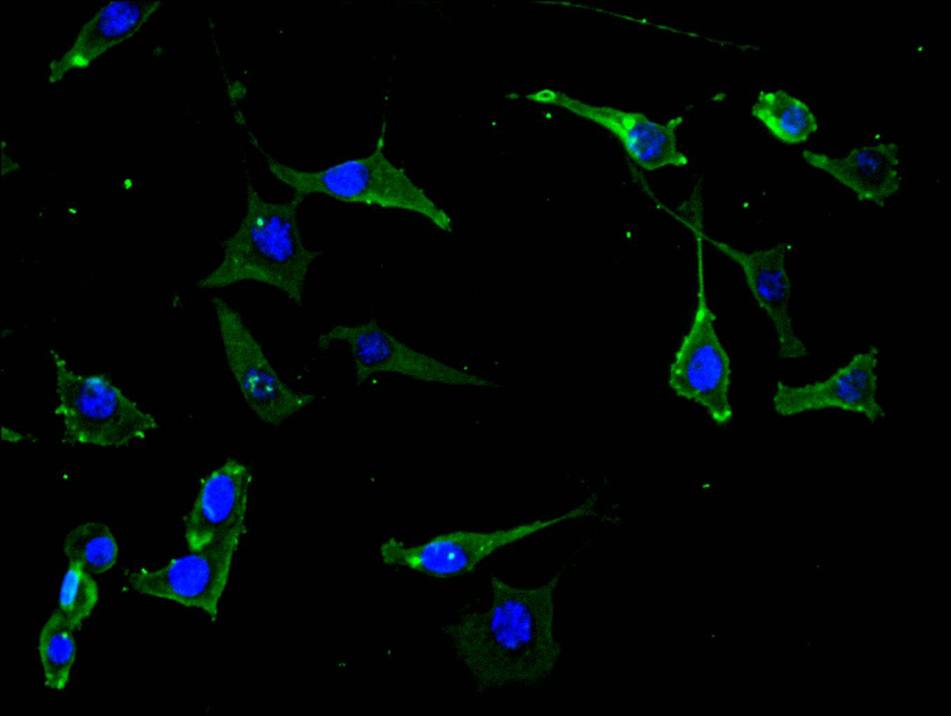 Immunofluorescence staining of RAC07911 cell at 1:30, counter-stained with DAPI. The cells were fixed in 4% formaldehyde and blocked in 10% normal Goat Serum. The cells were then incubated with the antibody overnight at 4C. The secondary antibody was FITC-conjugated AffiniPure Goat Anti-Mouse IgG(H+L).
