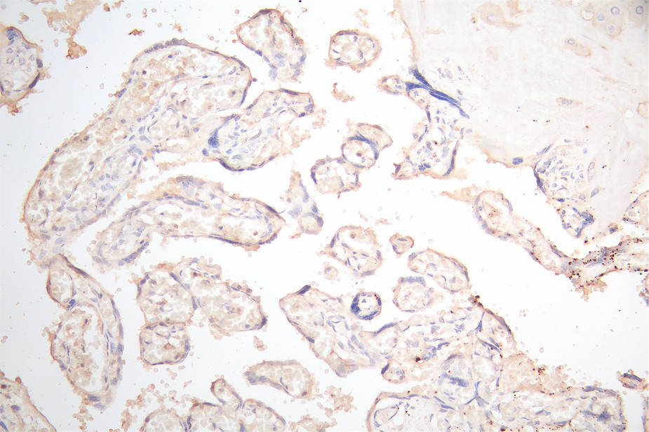 IHC image of RAC07915 diluted at 1:300 and staining in paraffin-embedded human placenta tissue performed on a Leica BondTM system. After dewaxing and hydration, antigen retrieval was mediated by high pressure in a citrate buffer (pH 6.0). Section was blocked with 10% normal goat serum 30min at RT. Then primary antibody (1% BSA) was incubated at 4Â°C overnight. The primary is detected by a Goat anti-Mouse IgG labeled by HRP and visualized using 0.05% DAB.