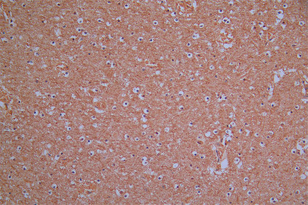 IHC image of RAC07923 diluted at 1:30 and staining in paraffin-embedded human brain tissue performed on a Leica BondTM system. After dewaxing and hydration, antigen retrieval was mediated by high pressure in a citrate buffer (pH 6.0). Section was blocked with 10% normal goat serum 30min at RT. Then primary antibody (1% BSA) was incubated at 4Â°C overnight. The primary is detected by a Goat anti-Mouse IgG labeled by HRP and visualized using 0.05% DAB.