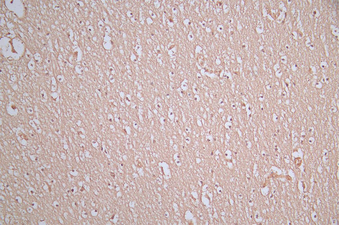 IHC image of RAC07929 diluted at 1:100 and staining in paraffin-embedded human brain tissue performed on a Leica BondTM system. After dewaxing and hydration, antigen retrieval was mediated by high pressure in a citrate buffer (pH 6.0). Section was blocked with 10% normal goat serum 30min at RT. Then primary antibody (1% BSA) was incubated at 4Â°C overnight. The primary is detected by a Goat anti-Mouse IgG labeled by HRP and visualized using 0.05% DAB.