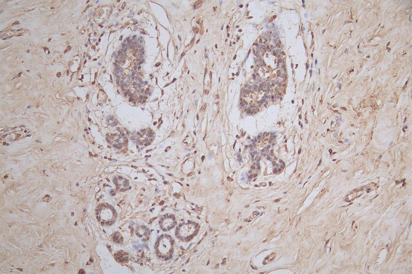IHC image of RAC07931 diluted at 1:50 and staining in paraffin-embedded human breast tissue performed on a Leica BondTM system. After dewaxing and hydration, antigen retrieval was mediated by high pressure in a citrate buffer (pH 6.0). Section was blocked with 10% normal goat serum 30min at RT. Then primary antibody (1% BSA) was incubated at 4Â°C overnight. The primary is detected by a Goat anti-mouse polymer IgG labeled by HRP and visualized using 0.05% DAB.