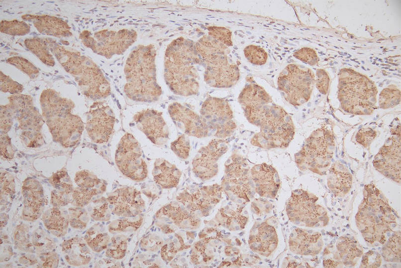 IHC image of RAC07931 diluted at 1:50 and staining in paraffin-embedded human stomach tissue performed on a Leica BondTM system. After dewaxing and hydration, antigen retrieval was mediated by high pressure in a citrate buffer (pH 6.0). Section was blocked with 10% normal goat serum 30min at RT. Then primary antibody (1% BSA) was incubated at 4Â°C overnight. The primary is detected by a Goat anti-mouse polymer IgG labeled by HRP and visualized using 0.05% DAB.