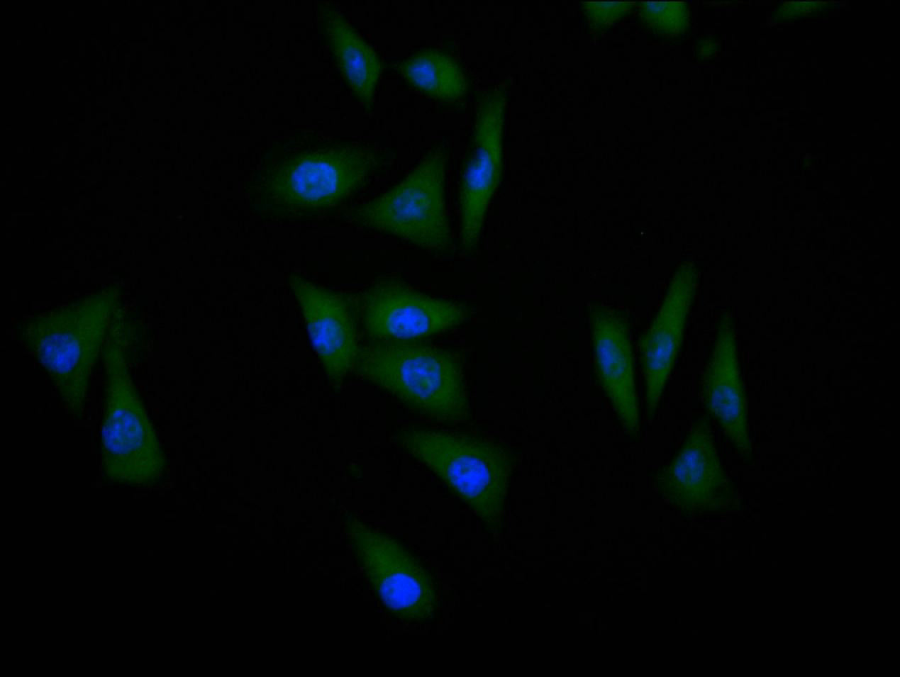 Immunofluorescence staining of MCF-7 cell with RAC07942 at 1:60, counter-stained with DAPI. The cells were fixed in 4% formaldehyde and blocked in 10% normal Goat Serum. The cells were then incubated with the antibody overnight at 4C. The secondary antibody was Alexa Fluor 488-congugated AffiniPure Goat Anti-Rabbit IgG(H+L).