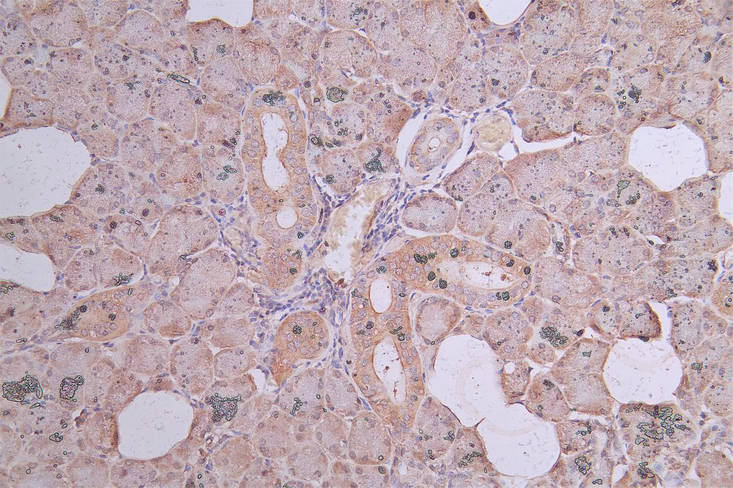 IHC image of RAC07946 diluted at 1:300 and staining in paraffin-embedded human pancreatic tissue performed on a Leica BondTM system. After dewaxing and hydration, antigen retrieval was mediated by high pressure in a citrate buffer (pH 6.0). Section was blocked with 10% normal goat serum 30min at RT. Then primary antibody (1% BSA) was incubated at 4Â°C overnight. The primary is detected by a Goat anti-Mouse IgG labeled by HRP and visualized using 0.05% DAB.