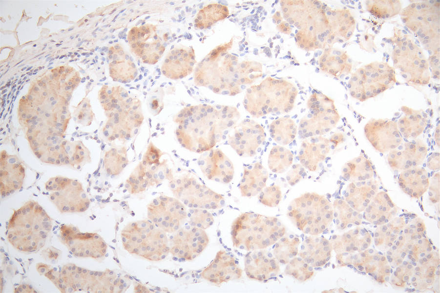 IHC image of RAC07948 diluted at 1:300 and staining in paraffin-embedded human stomach tissue performed on a Leica BondTM system. After dewaxing and hydration, antigen retrieval was mediated by high pressure in a citrate buffer (pH 6.0). Section was blocked with 10% normal goat serum 30min at RT. Then primary antibody (1% BSA) was incubated at 4Â°C overnight. The primary is detected by a Goat anti-Mouse IgG labeled by HRP and visualized using 0.05% DAB.