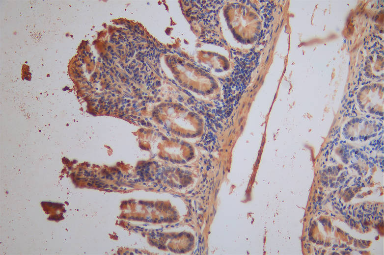 IHC image of RAC07951 diluted at 1:200 and staining in paraffin-embedded human small intestine tissue performed on a Leica BondTM system. After dewaxing and hydration, antigen retrieval was mediated by high pressure in a citrate buffer (pH 6.0). Section was blocked with 10% normal goat serum 30min at RT. Then primary antibody (1% BSA) was incubated at 4Â°C overnight. The primary is detected by a Goat anti-Mouse IgG labeled by HRP and visualized using 0.05% DAB.