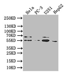 Western Blot, Positive WB detected in:Hela whole cell lysate, PC-3 whole cell lysate, U251 whole cell lysate, HepG2 whole cell lysate, All lanes: GIPR antibody at 1:1000, Secondary, Goat polyclonal to human IgG at 1/50000 dilution, Predicted band size: 54 kDa,49 kDa,50 kDa, Observed band size: 54 kDa