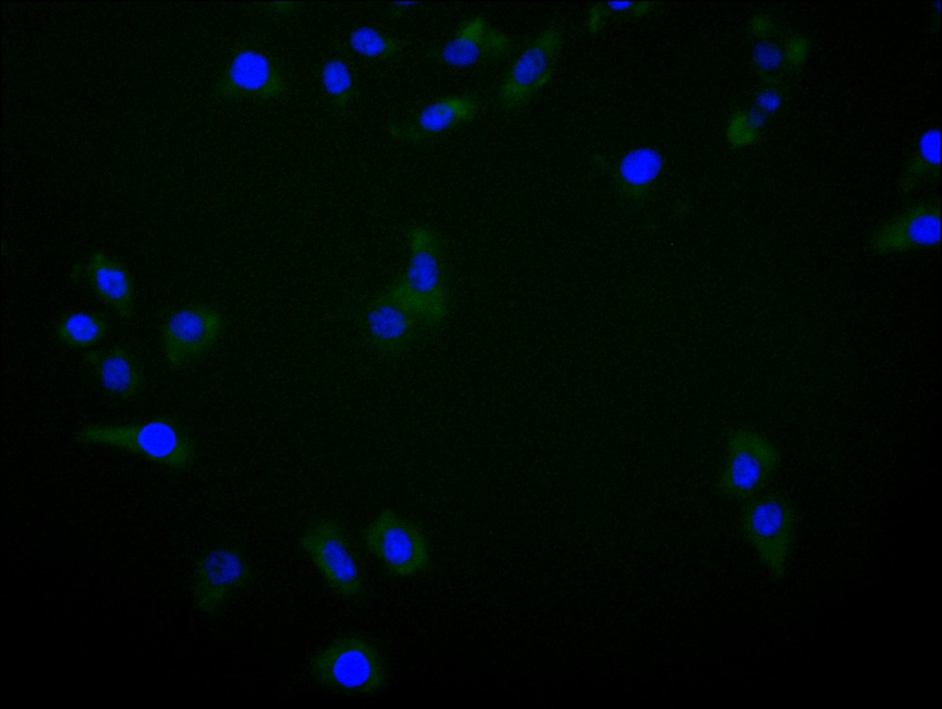 ImmunofluorescenceÂ stainingÂ ofÂ HelaÂ cellÂ withÂ RAC07969Â atÂ 1:30,Â counter-stainedÂ withÂ DAPI.Â TheÂ cellsÂ wereÂ fixedÂ inÂ 4%Â formaldehydeÂ andÂ blockedÂ inÂ 10%Â normalÂ GoatÂ Serum.Â TheÂ cellsÂ wereÂ thenÂ incubatedÂ withÂ theÂ antibodyÂ overnightÂ atÂ 4C.Â TheÂ secondaryÂ antibodyÂ wasÂ FITC-conjugatedÂ AffiniPureÂ GoatÂ Anti-HumanÂ IgG(H+L).