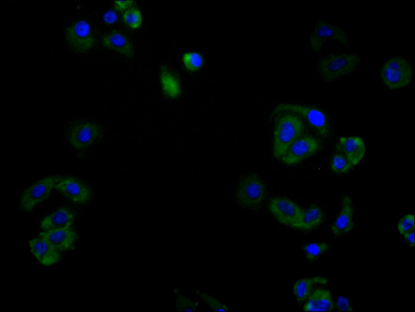 ImmunofluorescenceÂ stainingÂ ofÂ HelaÂ cellÂ withÂ RAC07982Â atÂ 1:80,Â counter-stainedÂ withÂ DAPI.Â TheÂ cellsÂ wereÂ fixedÂ inÂ 4%Â formaldehydeÂ andÂ blockedÂ inÂ 10%Â normalÂ GoatÂ Serum.Â TheÂ cellsÂ wereÂ thenÂ incubatedÂ withÂ theÂ antibodyÂ overnightÂ atÂ 4C.Â TheÂ secondaryÂ antibodyÂ wasÂ FITC-conjugatedÂ AffiniPureÂ GoatÂ Anti-HumanÂ IgG(H+L).