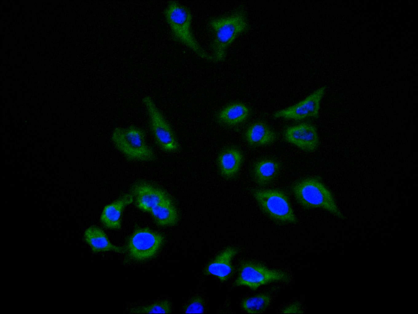 ImmunofluorescenceÂ stainingÂ ofÂ HelaÂ cellÂ withÂ RAC07984Â atÂ 1:150,Â counter-stainedÂ withÂ DAPI.Â TheÂ cellsÂ wereÂ fixedÂ inÂ 4%Â formaldehydeÂ andÂ blockedÂ inÂ 10%Â normalÂ GoatÂ Serum.Â TheÂ cellsÂ wereÂ thenÂ incubatedÂ withÂ theÂ antibodyÂ overnightÂ atÂ 4C.Â TheÂ secondaryÂ antibodyÂ wasÂ FITC-conjugatedÂ AffiniPureÂ GoatÂ Anti-HumanÂ IgG(H+L).