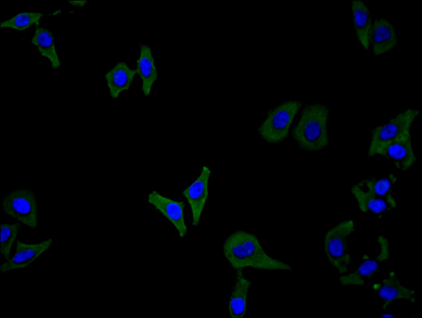 ImmunofluorescenceÂ stainingÂ ofÂ HelaÂ cellÂ withÂ RAC07985Â atÂ 1:100,Â counter-stainedÂ withÂ DAPI.Â TheÂ cellsÂ wereÂ fixedÂ inÂ 4%Â formaldehydeÂ andÂ blockedÂ inÂ 10%Â normalÂ GoatÂ Serum.Â TheÂ cellsÂ wereÂ thenÂ incubatedÂ withÂ theÂ antibodyÂ overnightÂ atÂ 4C.Â TheÂ secondaryÂ antibodyÂ wasÂ FITC-conjugatedÂ AffiniPureÂ GoatÂ Anti-HumanÂ IgG(H+L).