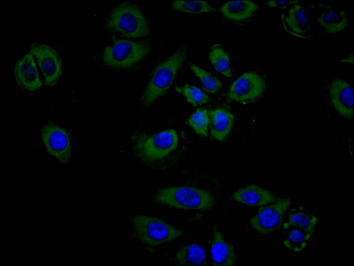 ImmunofluorescenceÂ stainingÂ ofÂ A549 cellÂ withÂ RAC07985Â atÂ 1:100,Â counter-stainedÂ withÂ DAPI.Â TheÂ cellsÂ wereÂ fixedÂ inÂ 4%Â formaldehydeÂ andÂ blockedÂ inÂ 10%Â normalÂ GoatÂ Serum.Â TheÂ cellsÂ wereÂ thenÂ incubatedÂ withÂ theÂ antibodyÂ overnightÂ atÂ 4C.Â TheÂ secondaryÂ antibodyÂ wasÂ FITC-conjugatedÂ AffiniPureÂ GoatÂ Anti-HumanÂ IgG(H+L).