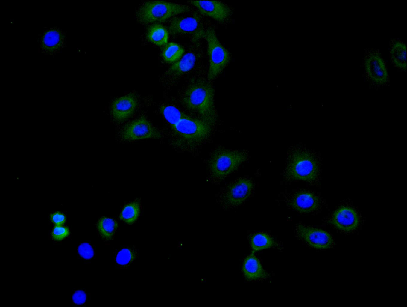 ImmunofluorescenceÂ stainingÂ ofÂ HelaÂ cellÂ withÂ RAC07987Â atÂ 1:50,Â counter-stainedÂ withÂ DAPI.Â TheÂ cellsÂ wereÂ fixedÂ inÂ 4%Â formaldehydeÂ andÂ blockedÂ inÂ 10%Â normalÂ GoatÂ Serum.Â TheÂ cellsÂ wereÂ thenÂ incubatedÂ withÂ theÂ antibodyÂ overnightÂ atÂ 4C.Â TheÂ secondaryÂ antibodyÂ wasÂ FITC-conjugatedÂ AffiniPureÂ GoatÂ Anti-HumanÂ IgG(H+L).