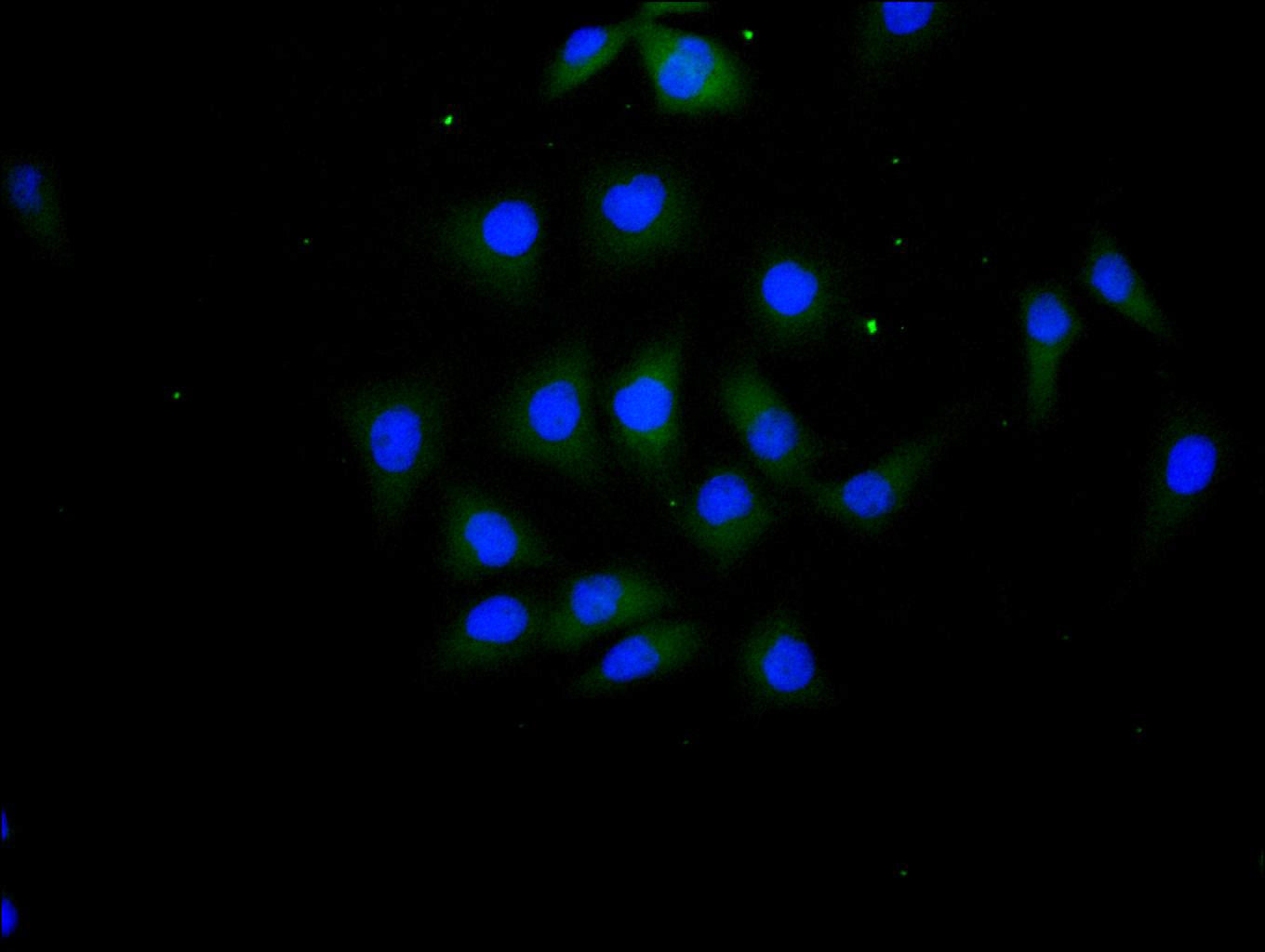 ImmunofluorescenceÂ stainingÂ ofÂ MCF7Â cellÂ withÂ RAC07992Â atÂ 1:100,Â counter-stainedÂ withÂ DAPI.Â TheÂ cellsÂ wereÂ fixedÂ inÂ 4%Â formaldehydeÂ andÂ blockedÂ inÂ 10%Â normalÂ GoatÂ Serum.Â TheÂ cellsÂ wereÂ thenÂ incubatedÂ withÂ theÂ antibodyÂ overnightÂ atÂ 4C.Â TheÂ secondaryÂ antibodyÂ wasÂ FITC-conjugatedÂ AffiniPureÂ GoatÂ Anti-HumanÂ IgG(H+L).