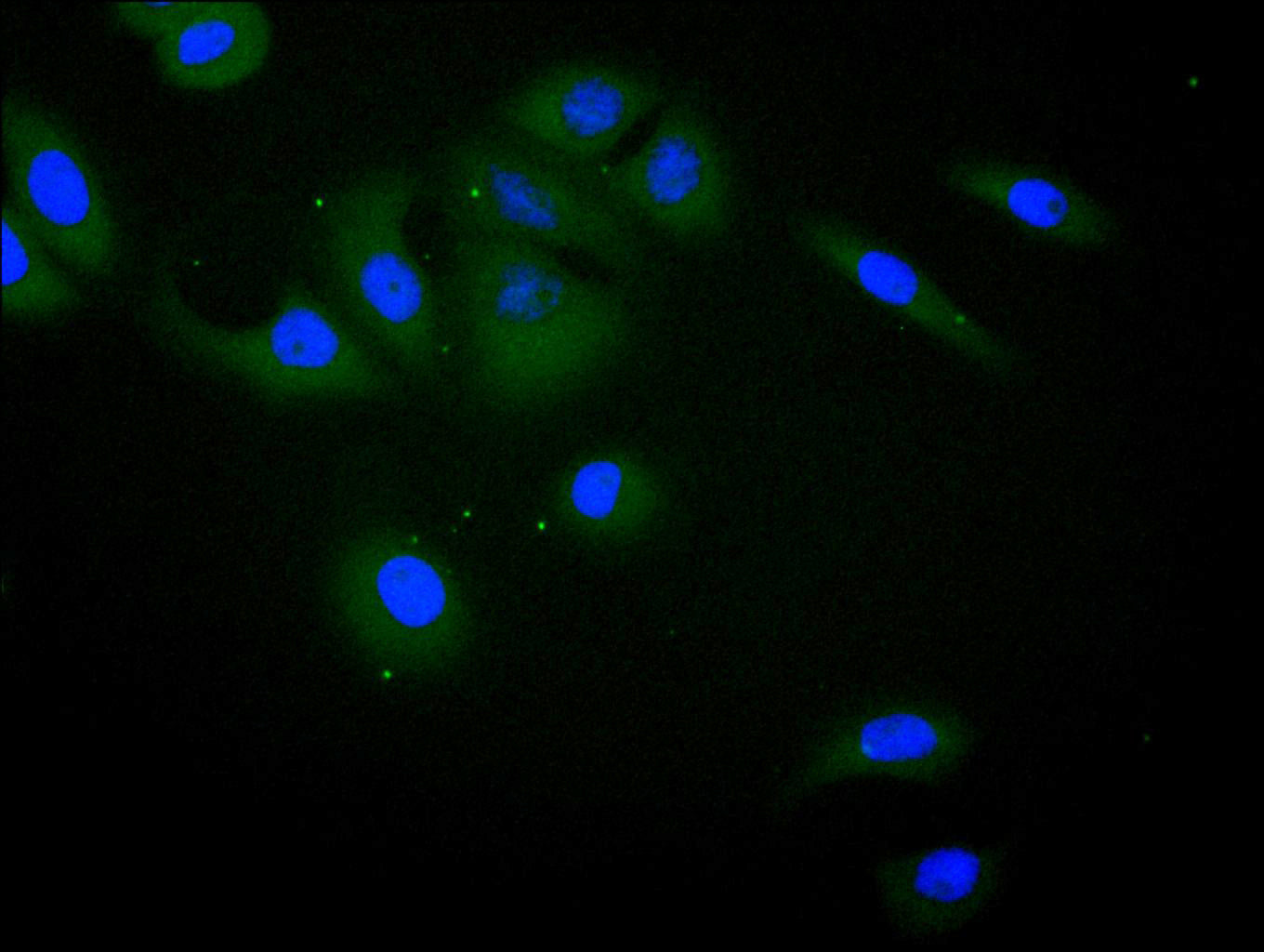 ImmunofluorescenceÂ stainingÂ ofÂ A549Â cellÂ withÂ RAC07992Â atÂ 1:100,Â counter-stainedÂ withÂ DAPI.Â TheÂ cellsÂ wereÂ fixedÂ inÂ 4%Â formaldehydeÂ andÂ blockedÂ inÂ 10%Â normalÂ GoatÂ Serum.Â TheÂ cellsÂ wereÂ thenÂ incubatedÂ withÂ theÂ antibodyÂ overnightÂ atÂ 4C.Â TheÂ secondaryÂ antibodyÂ wasÂ FITC-conjugatedÂ AffiniPureÂ GoatÂ Anti-HumanÂ IgG(H+L).