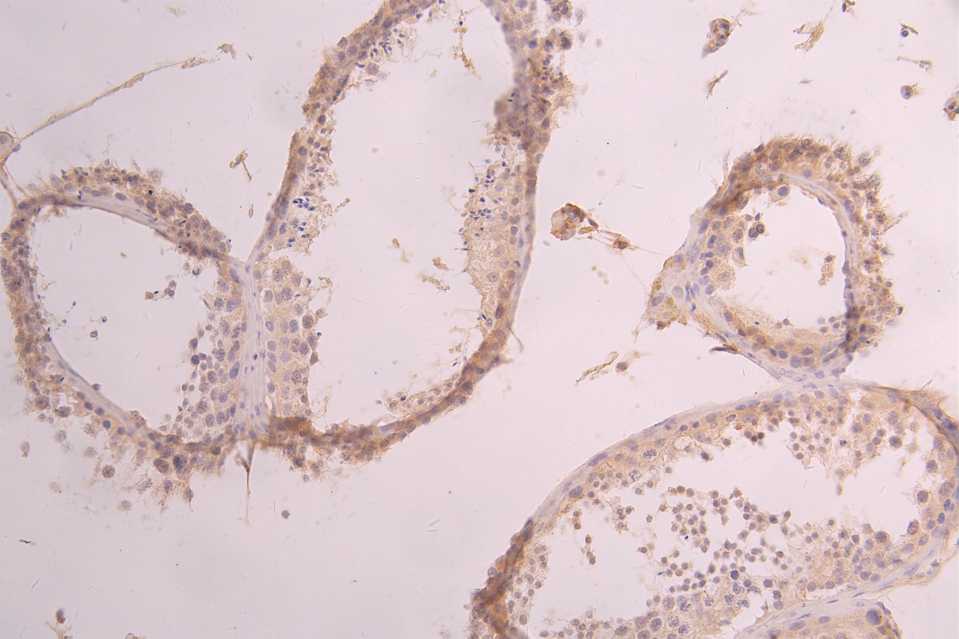 IHC image of RAC08001 diluted at 1ï¼50 and staining in paraffin-embedded human testis tissue performed on a Leica BondTM system. After dewaxing and hydration, antigen retrieval was mediated by high pressure in a citrate buffer (pH 6.0). Section was blocked with 10% normal goat serum 30min at RT. Then primary antibody (1% BSA) was incubated at 4Â°C overnight. The primary is detected by a Goat anti-human polymer IgG labeled by HRP and visualized using 0.05% DAB.